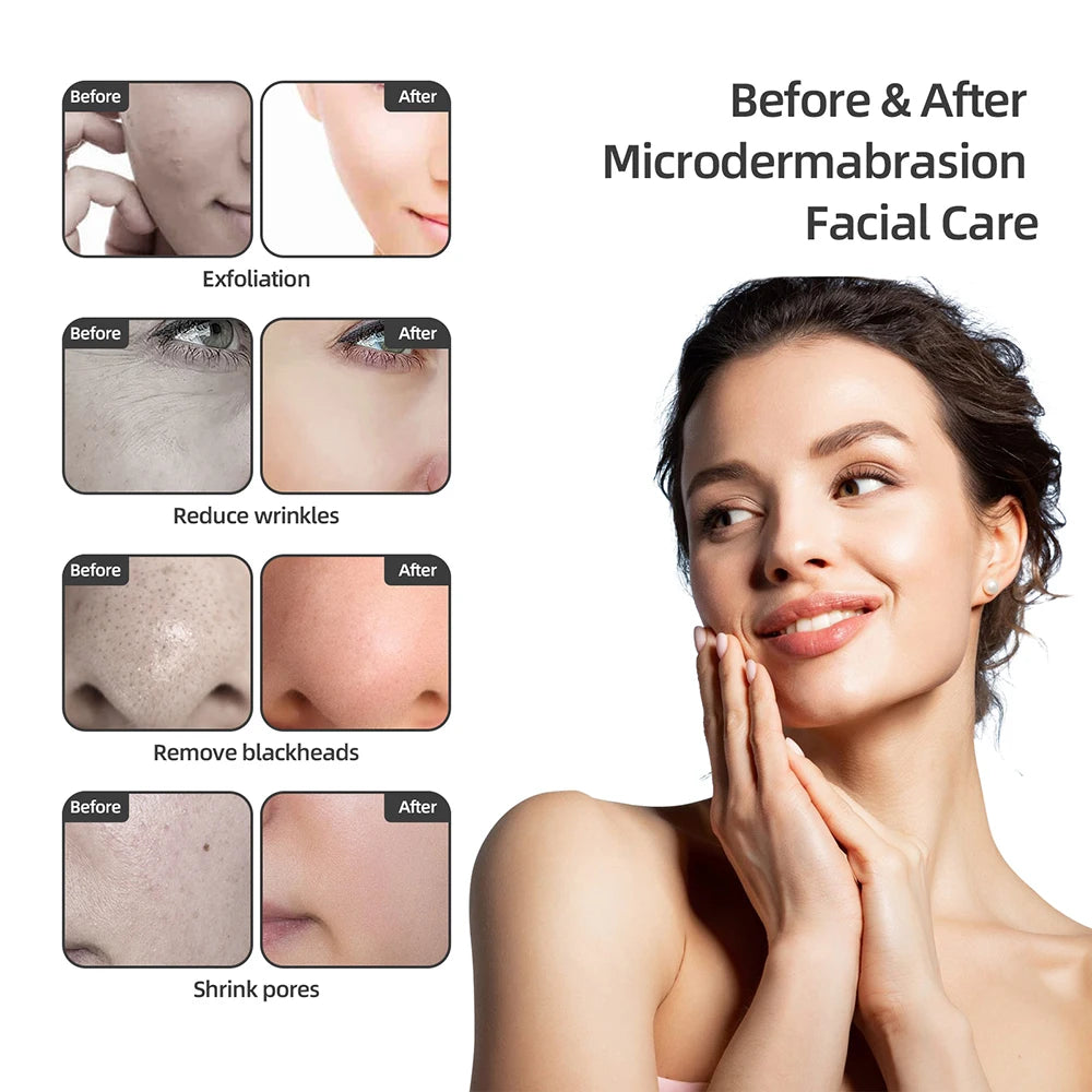 Foreverlily Diamond Microdermabrasion Machine With Water Spray