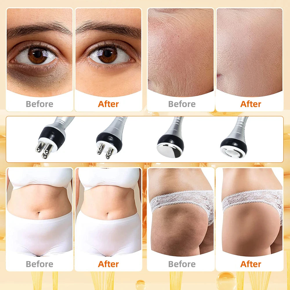 Missheart Cavitation Ultrasonic Body Slimming Machine Facial Massager